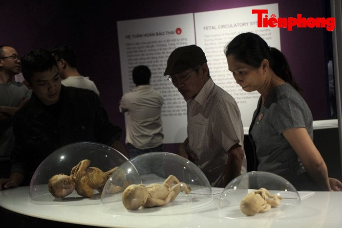 Triển lãm xác người ở TPHCM: Về phương diện y khoa thì rất ý nghĩa ảnh 7