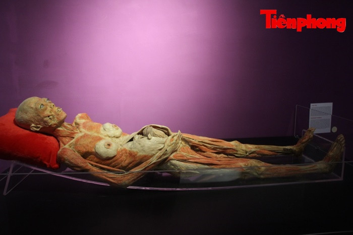 Triển lãm xác người ở TPHCM: Về phương diện y khoa thì rất ý nghĩa ảnh 5