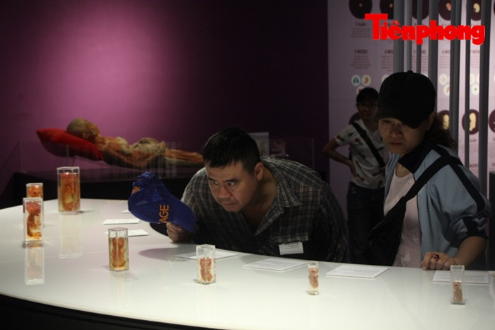 Triển lãm xác người ở TPHCM: Về phương diện y khoa thì rất ý nghĩa ảnh 4