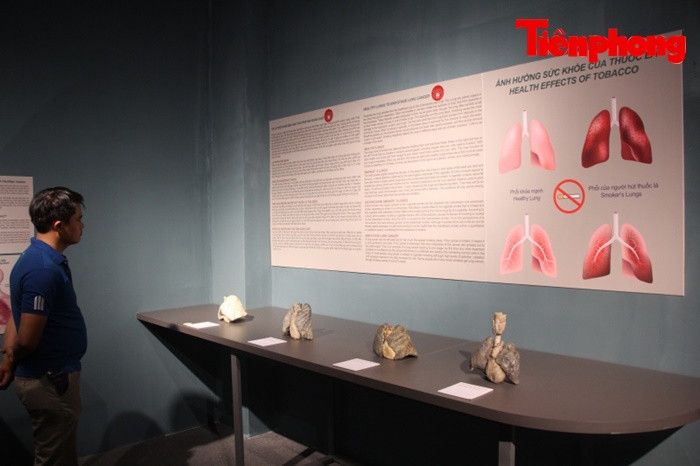 Triển lãm xác người ở TPHCM: Về phương diện y khoa thì rất ý nghĩa ảnh 9