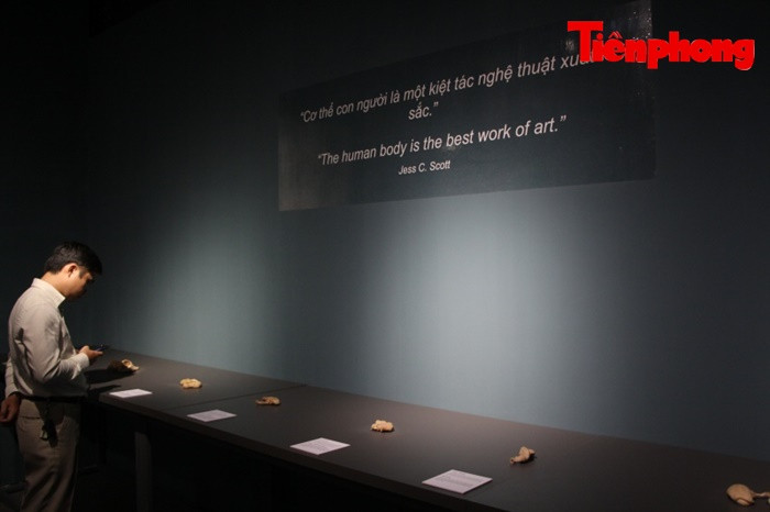 Triển lãm xác người ở TPHCM: Về phương diện y khoa thì rất ý nghĩa ảnh 10