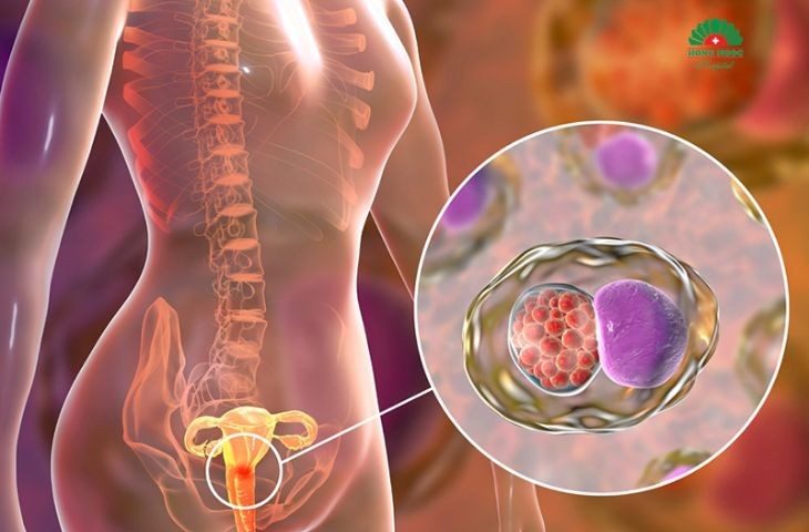 Tế bào T điều hòa, hay Treg, là một nhóm nhỏ tế bào T giúp điều hòa hệ miễn dịch Tế bào T điều hòa, hay Treg, là một nhóm nhỏ tế bào T giúp điều hòa hệ miễn dịch