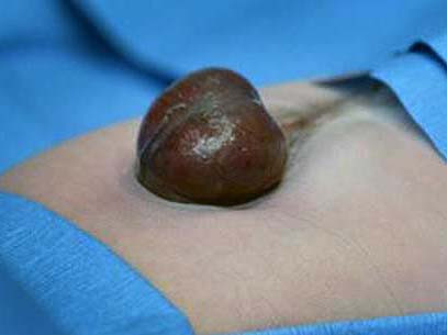 Tim của Audrina thay vì nằm trong lồng ngực lại lòi ra ngoài khiến cho cô bé suýt mất mạng . Tim của Audrina thay vì nằm trong lồng ngực lại lòi ra ngoài khiến cho cô bé suýt mất mạng