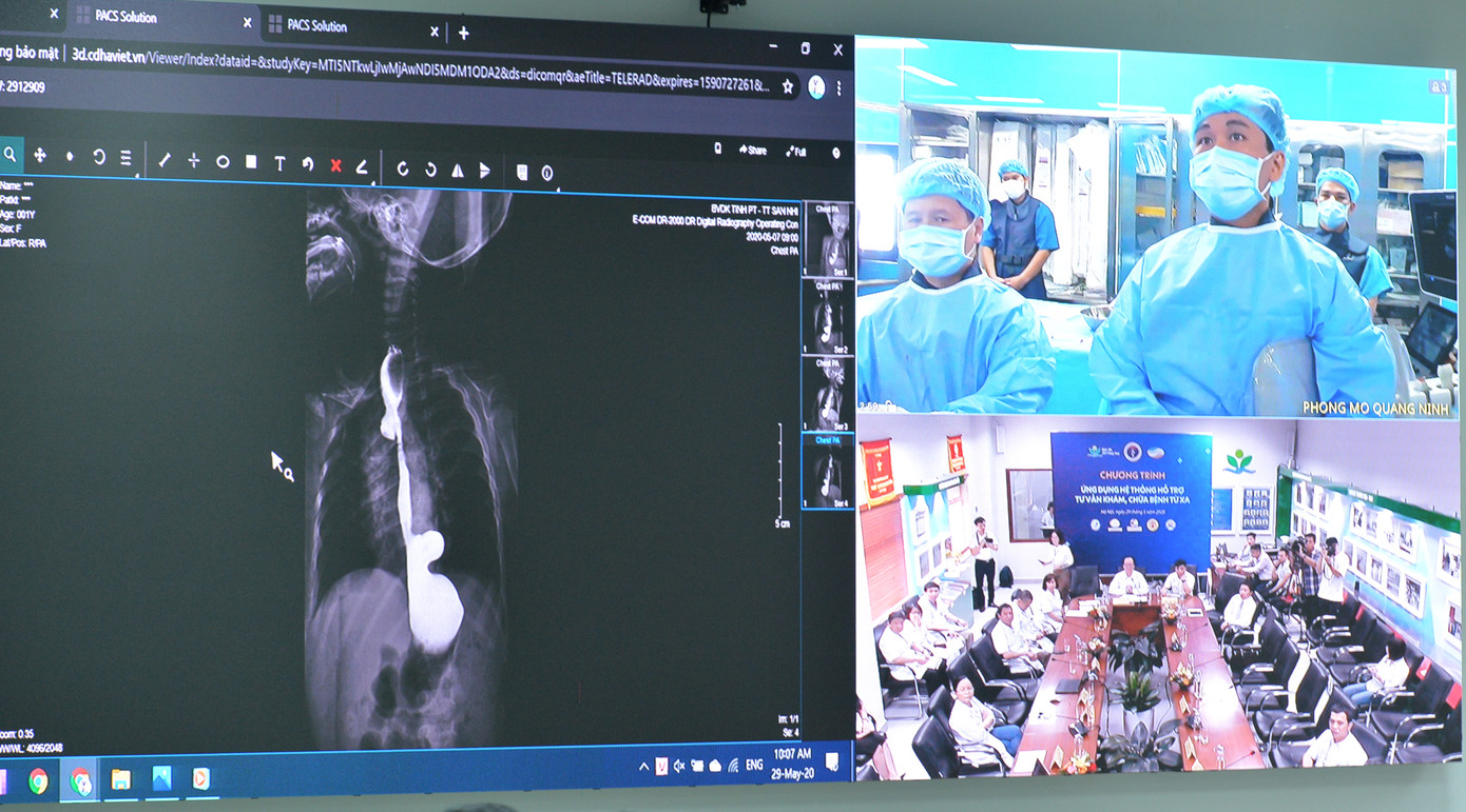 Không cần trực tiếp có mặt tại phòng phẫu thuật, các bác sĩ Bệnh viện Nhi Trung ương có thể can thiệp trực tiếp vào ca mổ cho bệnh nhi 23 ngày tuổi tại Bệnh viện Sản Nhi Quảng Ninh qua hệ thống Telehealth của Viettel Solutions. Không cần trực tiếp có mặt tại phòng phẫu thuật, các bác sĩ Bệnh viện Nhi Trung ương có thể can thiệp trực tiếp vào ca mổ cho bệnh nhi 23 ngày tuổi tại Bệnh viện Sản Nhi Quảng Ninh qua hệ thống Telehealth của Viettel Solutions.