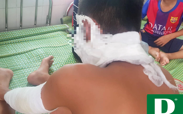 Chùm bóng bay phát nổ, 3 cầu thủ U14 Sông Lam Nghệ An nhập viện ảnh 3