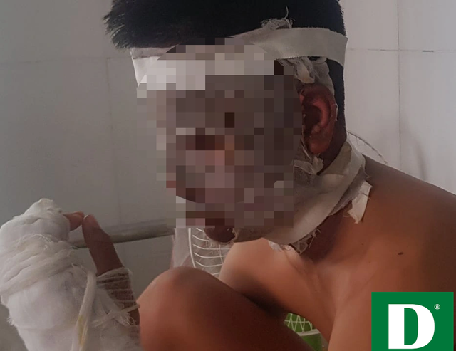 Chùm bóng bay phát nổ, 3 cầu thủ U14 Sông Lam Nghệ An nhập viện ảnh 2