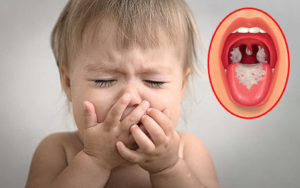 Trẻ em cũng là đối tượng có nguy cơ cao bị bạch hầu nếu không được tiêm phòng đầy đủ. Trẻ em cũng là đối tượng có nguy cơ cao bị bạch hầu nếu không được tiêm phòng đầy đủ.