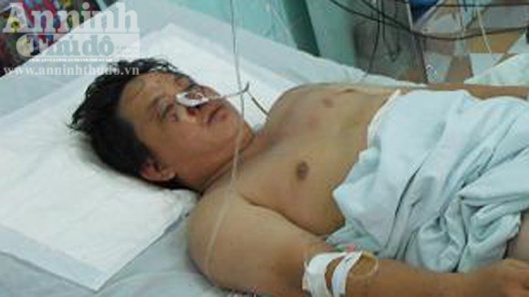 Đến sáng 8-11, anh Dương Hoàng Dũng đã tỉnh táo sau phẫu thuật. Đến sáng 8-11, anh Dương Hoàng Dũng đã tỉnh táo sau phẫu thuật