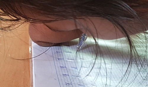 Nghị lực phi thường của cô bé 'chim cánh cụt' ở miền Tây