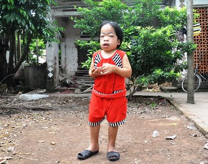 18 tuổi nhưng Loan chỉ cao gần 80cm, nặng 22kg..