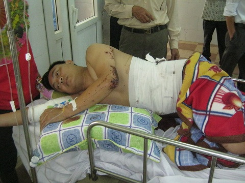 Hiện trường vụ nổ kinh hoàng trên xe giường nằm ảnh 2