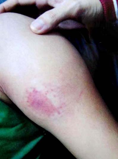 Kẻ cuồng dâm tấn công em vợ vẫn nhởn nhơ ảnh 1