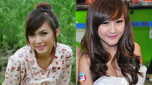 Kelly Nguyễn trước (trái) và sau khi phẫu thuật cằm - Ảnh: T.L