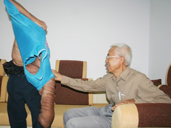 Việc sinh hoạt thường ngày của Vũ gặp rất nhiều khó khăn