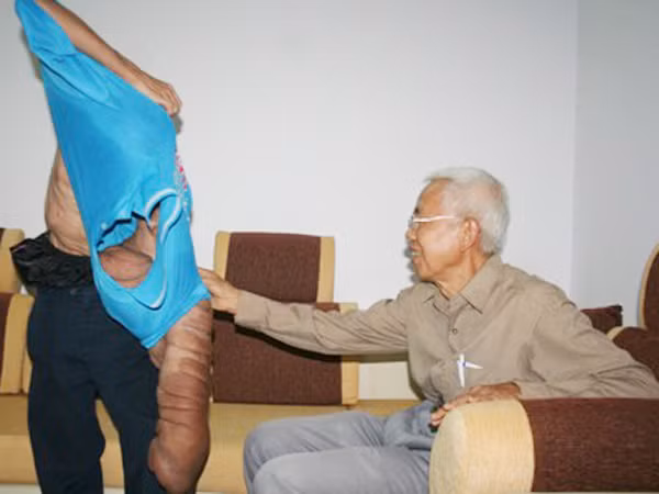 Việc sinh hoạt thường ngày của Vũ gặp rất nhiều khó khăn. Việc sinh hoạt thường ngày của Vũ gặp rất nhiều khó khăn