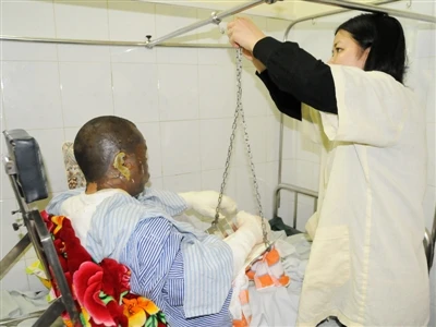 Bệnh nhân Đỗ Ngọc Mạnh (38 tuổi) bị bỏng lửa 24%, bỏng sâu 7%, bỏng hô hấp. Ảnh: Tuấn Nguyễn