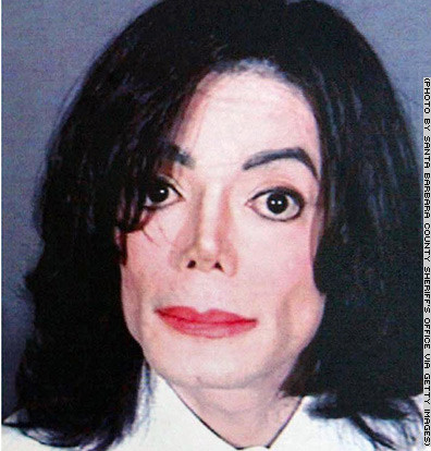 Michael Jackson cũng là thảm họa của các ca phẫu thuật