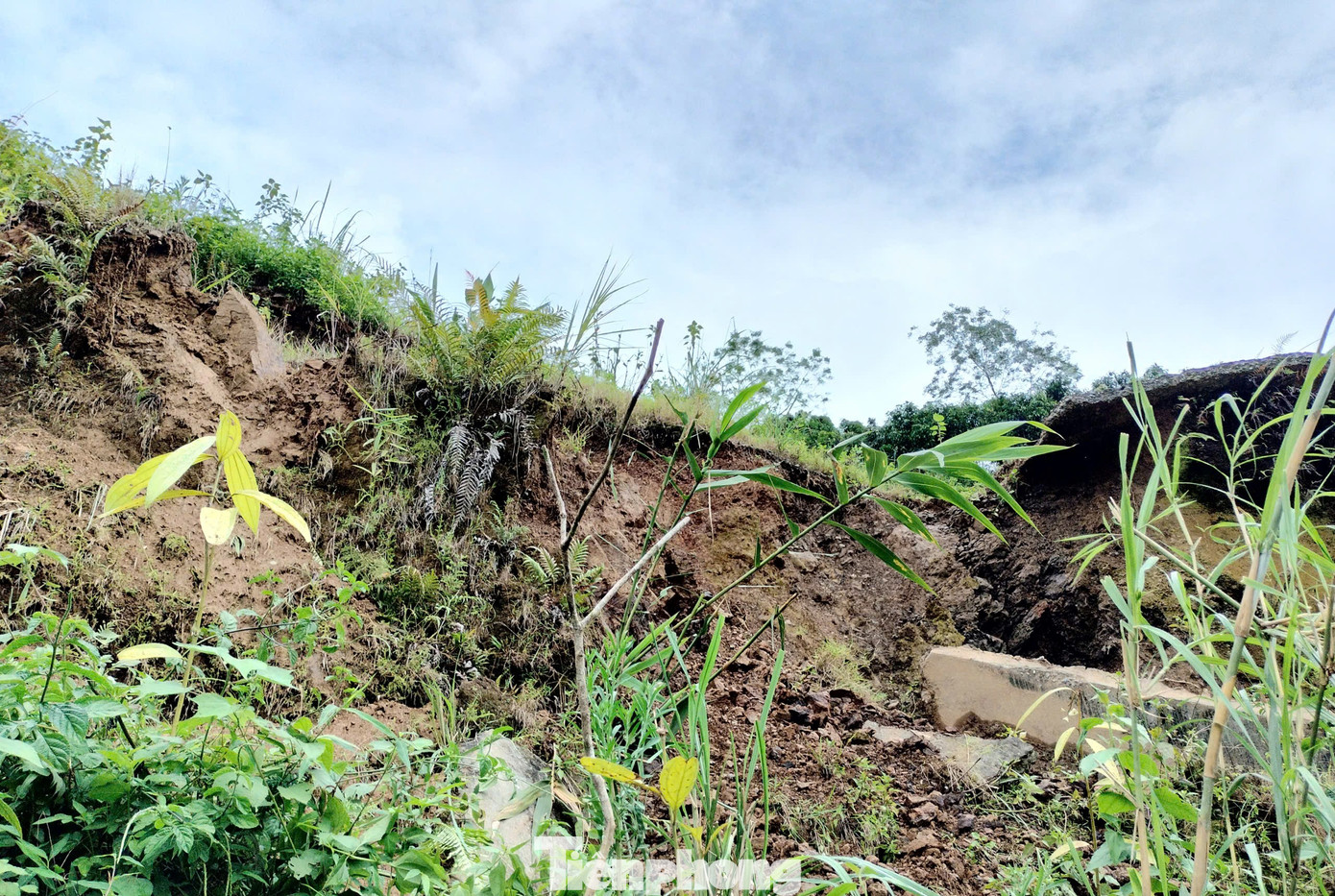 Nhiều điểm hở hàm ếch, nứt gẫy rộng. Nhiều điểm hở hàm ếch, nứt gẫy rộng.