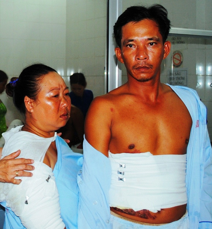 Vợ chồng ông Quang bị bỏng 