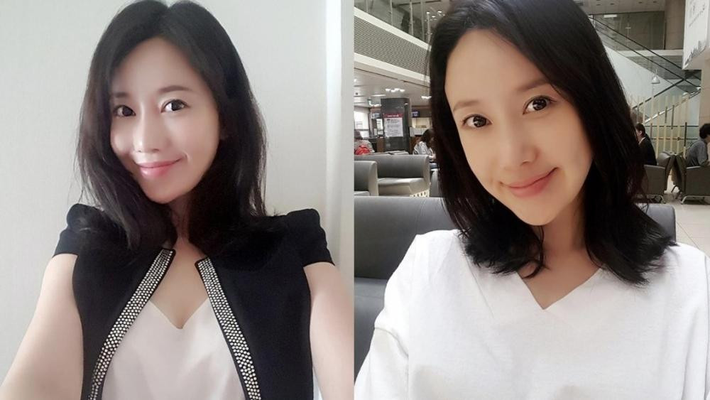 Jeon Eun-Mi hiện chủ yếu hoạt động trên cộng đồng mạng xã hội và không có bất cứ liên quan nào đến làng giải trí.