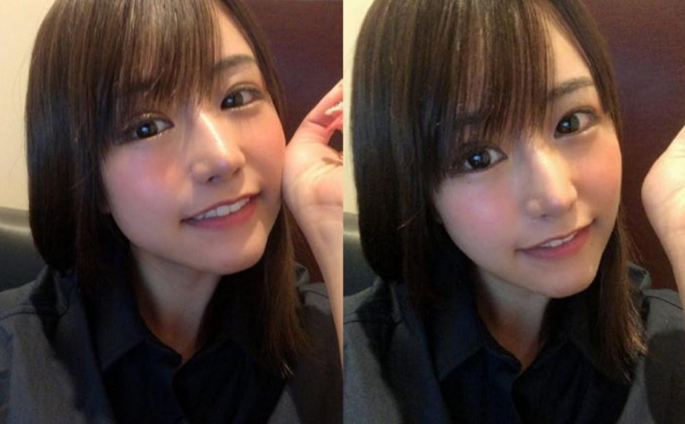Mikishi sau khi trải qua 4 lần phẫu thuật thẩm mỹ.