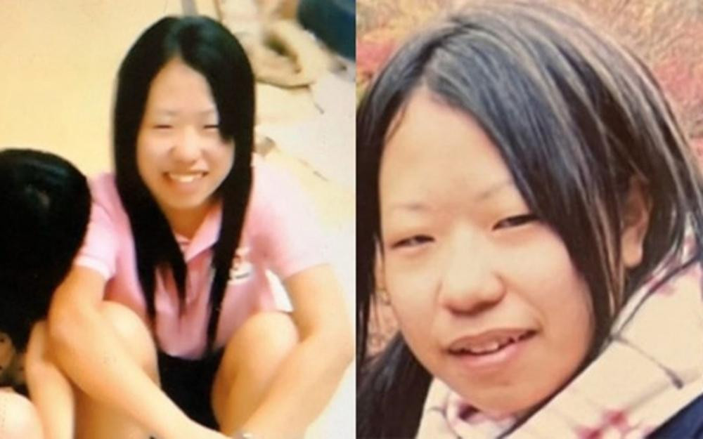 Mikishi thời học trung học, trước khi phẫu thuật thẩm mỹ.