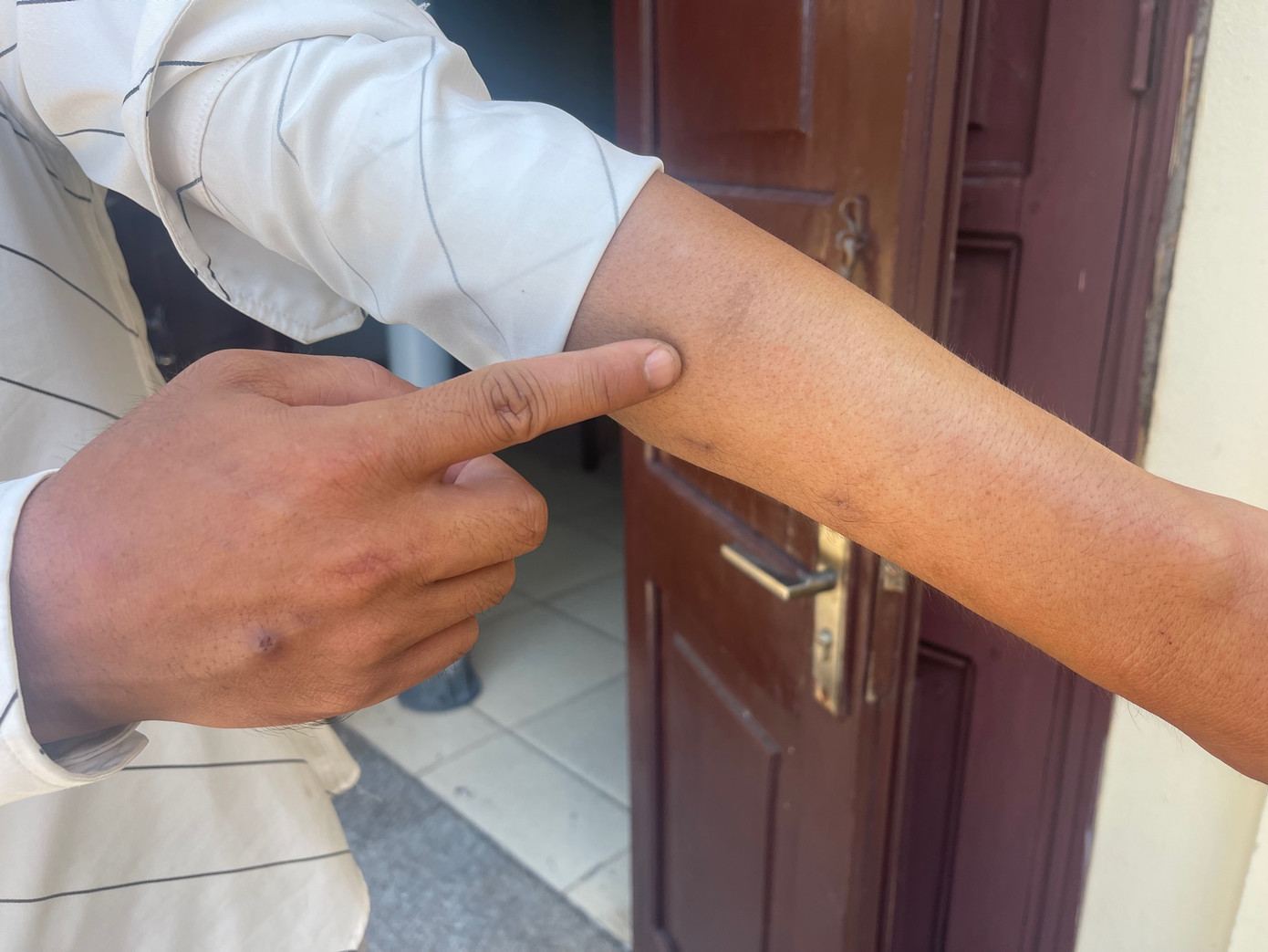 Bị cáo Ngô Mạnh Linh chỉ thương tích bị chém nay đã mờ Bị cáo Ngô Mạnh Linh chỉ thương tích bị chém nay đã mờ