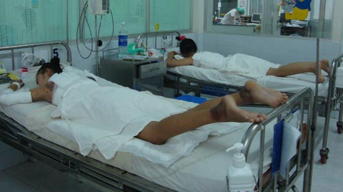 Thủy Tiên (trái) tại khoa phỏng - chỉnh hình (Bệnh viện Nhi Đồng 1) với bắp tay và lưng bị cháy đen