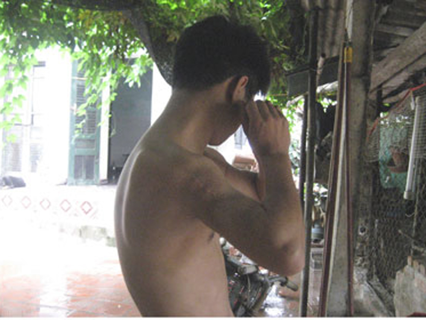 Em T.V.Hưng không có tiến triển nhiều sau mổ, ngoại trừ hai vết sẹo to trên hai bắp tay (Thanh Niên)