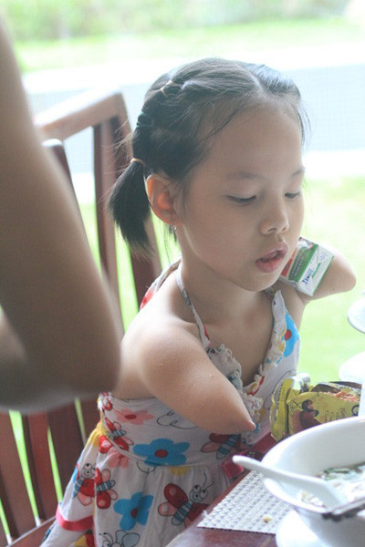 Nhưng em không thể tự xúc đồ ăn được. Mong muốn em là học hỏi và thành công theo tấm gương của anh Nick