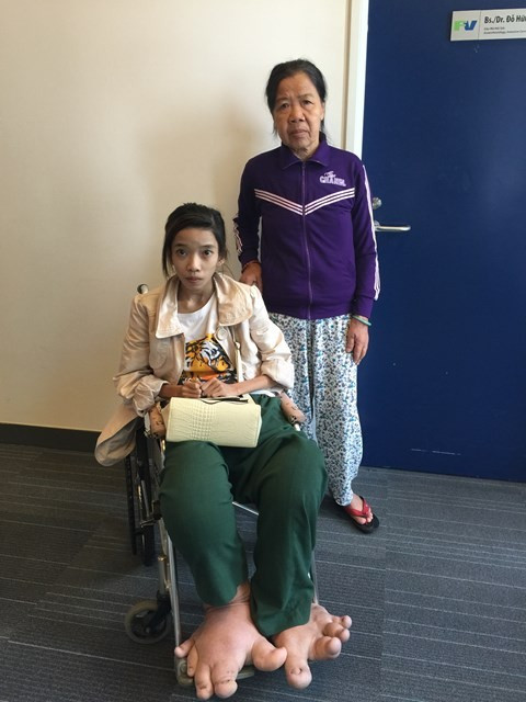 Nỗi cơ cực của thiếu nữ có đôi chân voi khổng lồ ảnh 1