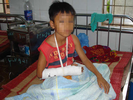 Cháu Q. đang điều trị vết thương tại bệnh viện - Ảnh: T.N.Q