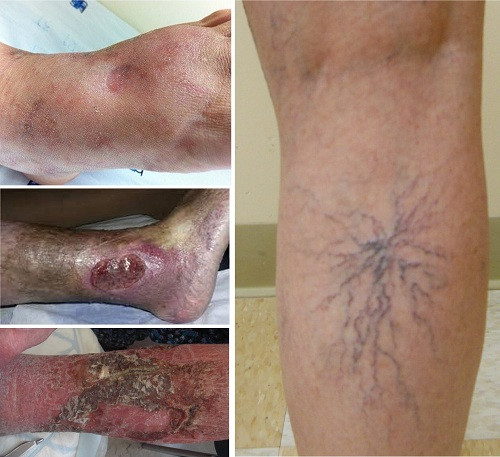 nhung-loi-ich-tu-15-phut-di-bo-nhanh-1