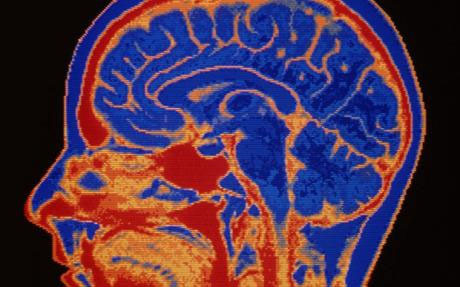 Hình ảnh minh họa lát cắt ngang bộ não con người. Ảnh: Telegraph