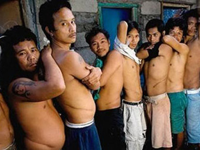 Các nạn nhân của đường dây buôn bán nội tạng người bất hợp pháp với những vết sẹo dài trên cơ thể. Các nạn nhân của đường dây buôn bán nội tạng người bất hợp pháp với những vết sẹo dài trên cơ thể