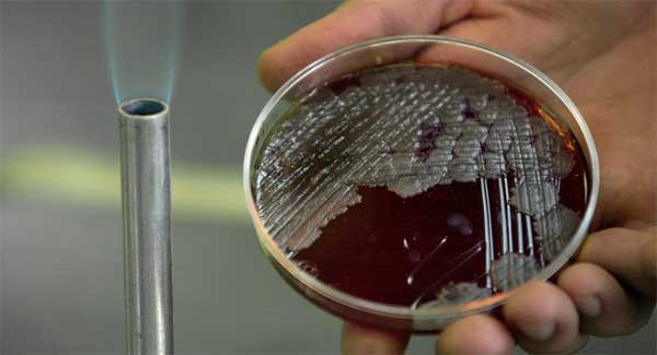 Bệnh than, nỗi ám ảnh từ lính Bắc Triều Tiên đào tẩu ảnh 1