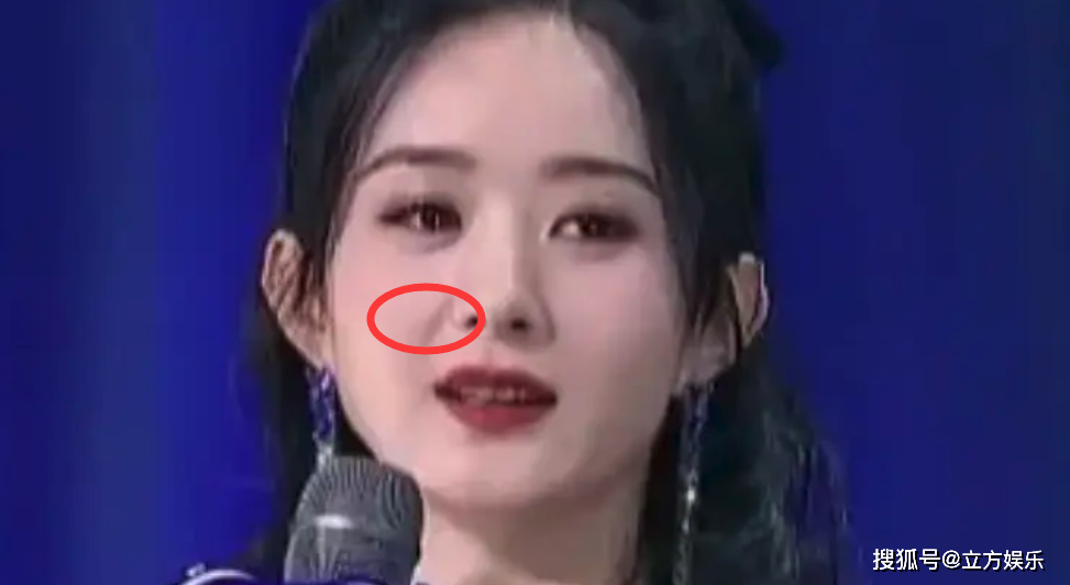 Cô còn lộ bọng mắt to, thâm quầng. Dân mạng đoán, liên tục chạy show khiến Lệ Dĩnh không có nhiều thời gian nghỉ ngơi, cũng không ngủ đủ giấc.