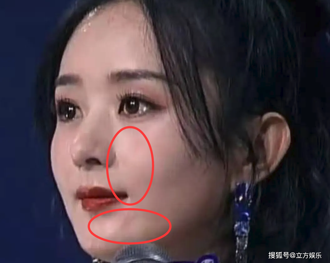 Ở tuổi 34, ngôi sao &quot;Hữu Phỉ&quot; lộ loạt dấu hiệu lão hóa như nếp nhăn ở phần mũi, xung quanh vùng miệng.