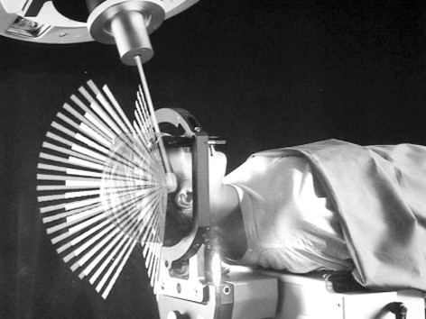 Điều trị ung thư bằng dao Photon