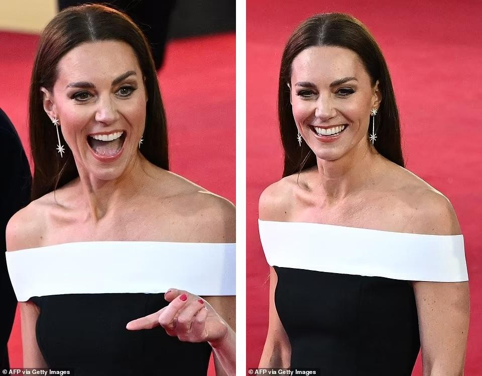 Công nương Kate tỏa sáng với nụ cười rạng rỡ. Tuy nhiên, ở tuổi 40, cô đã lộ rõ dấu hiệu lão hóa trên khuôn mặt, nhiều nhất là quanh miệng.