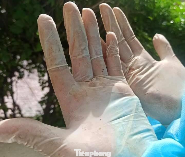 Cả hai tình nguyên viên cho biết đây là lần đầu tiên hỗ trợ sản phụ sinh đẻ