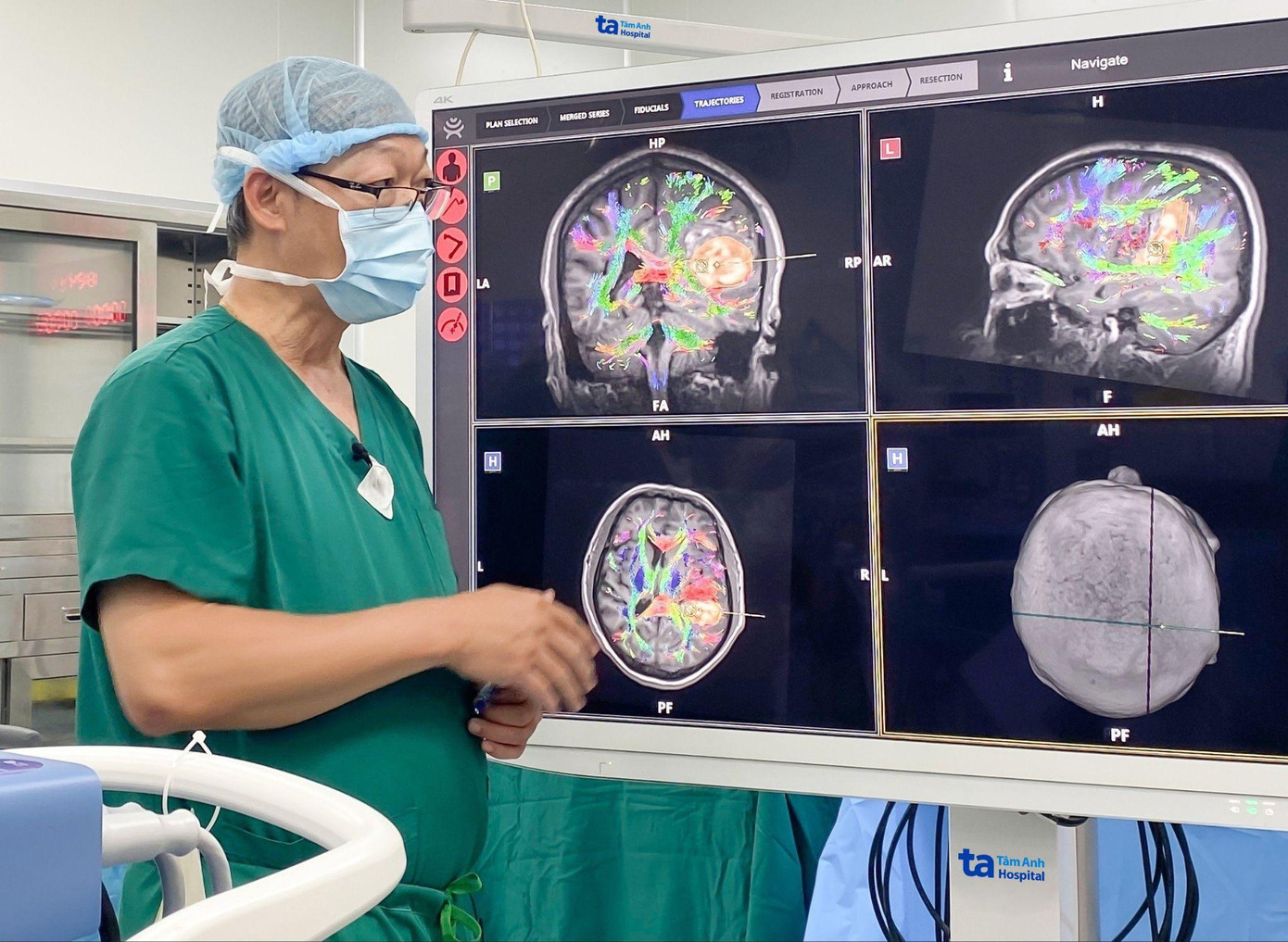 ThS.BS.CKII Chu Tấn Sĩ xem khối máu tụ trong não của bệnh nhân trước khi tiến hành phẫu thuật. Ảnh: Bệnh viện Đa khoa Tâm Anh. ThS.BS.CKII Chu Tấn Sĩ xem khối máu tụ trong não của bệnh nhân trước khi tiến hành phẫu thuật. Ảnh: Bệnh viện Đa khoa Tâm Anh.