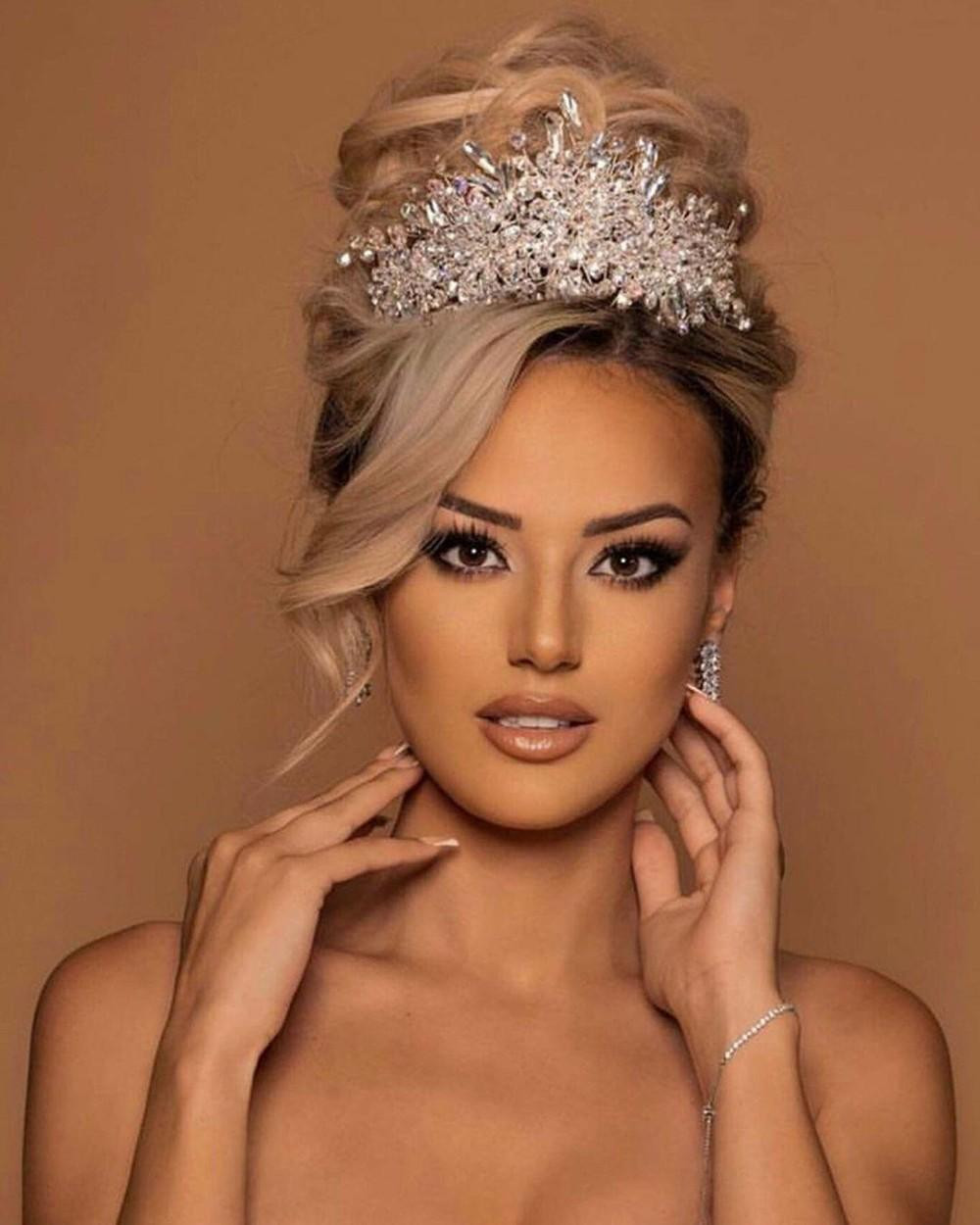 Edona Lie bỏ thi vì tình hình sức khỏe. Ảnh: MGI.