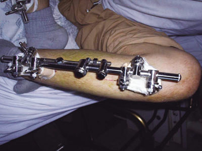 Ảnh: minh họa - Internet Ảnh: minh họa - Internet