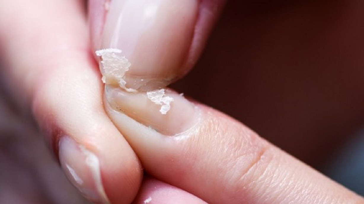 Móng tay giòn cũng là dấu hiệu của lượng canxi trong cơ thể bạn thấp. Móng tay giòn cũng là dấu hiệu của lượng canxi trong cơ thể bạn thấp.