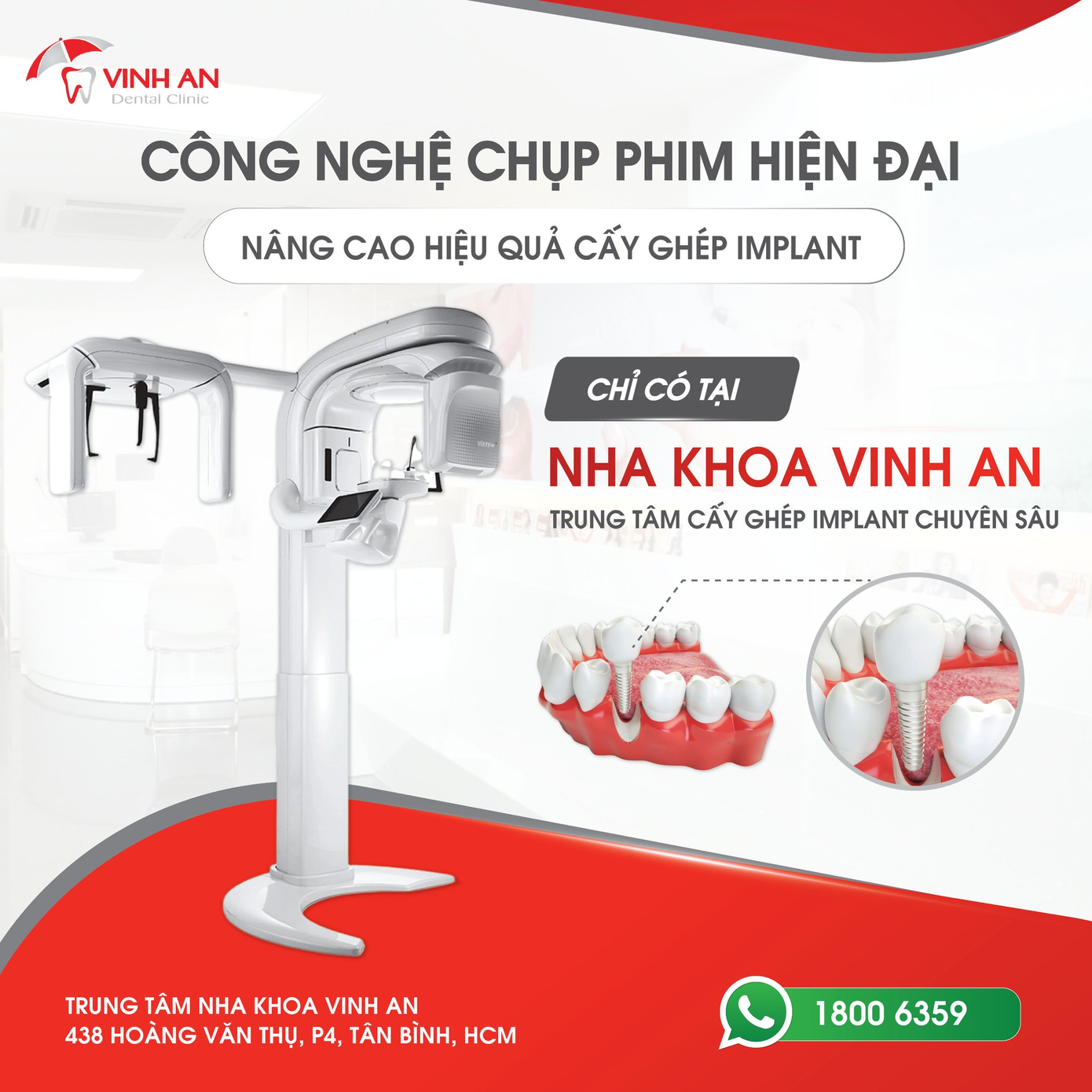 Vinh An là Nha khoa đầu tiên sở hữu máy chụp CBCT T2 hiện đại