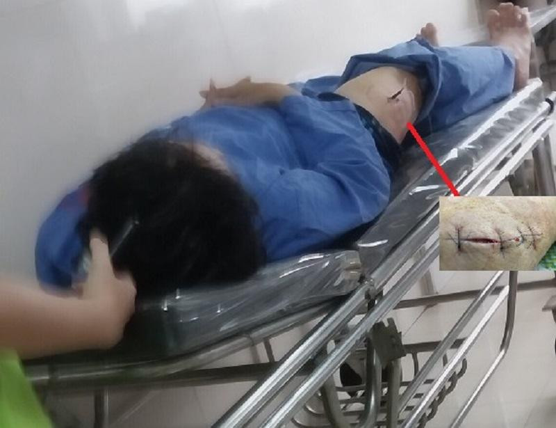 Ông Giản là người đang tố cáo nhiều vấn đề tiêu cực, tham nhũng tại Cục Thuế Ninh Bình