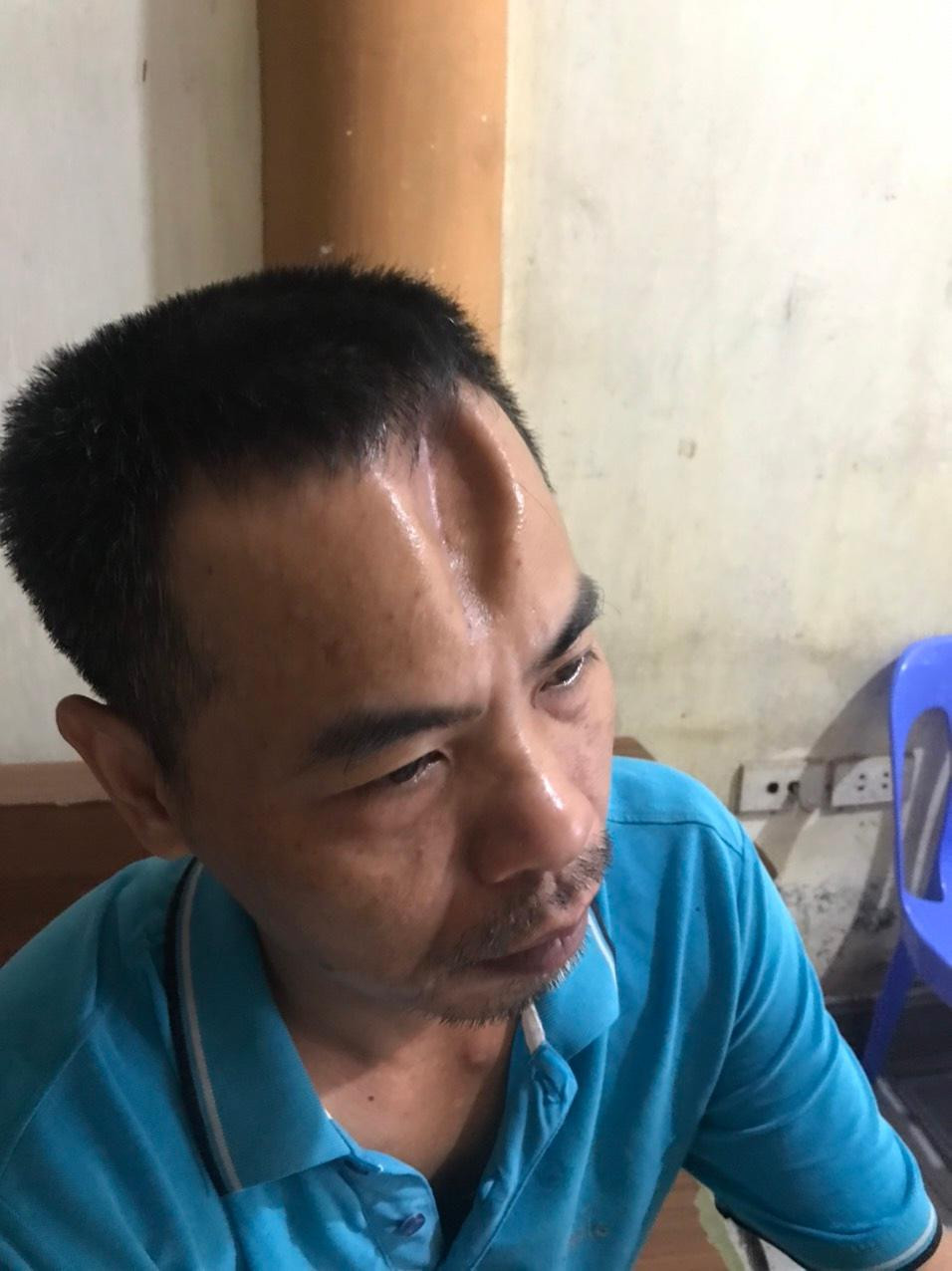 Anh Thưởng sau khi được xuất viện. Anh Thưởng sau khi được xuất viện.