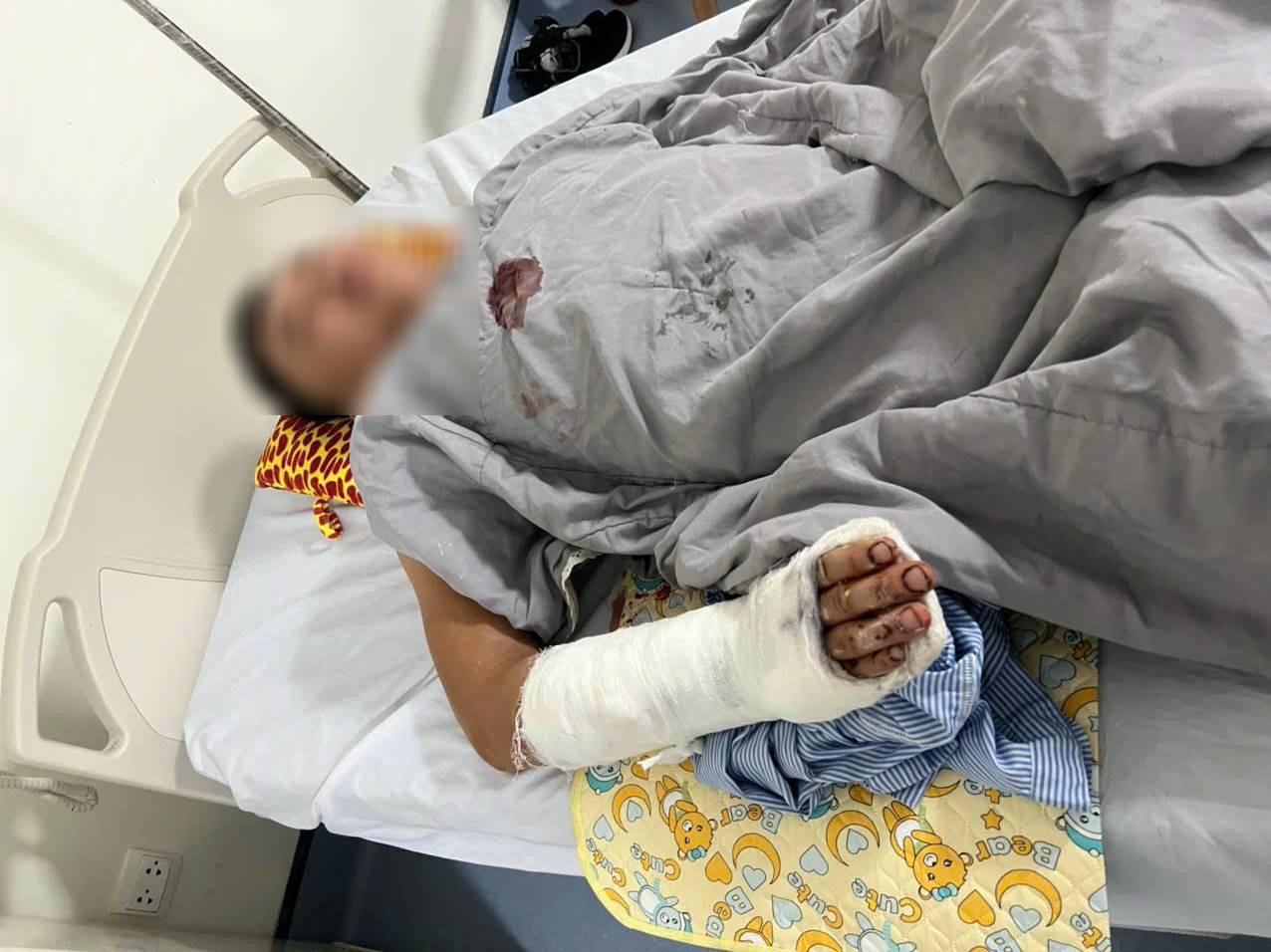 Anh Đ. được xác định bị đa vết thương, tổn thương cẳng tay, bàn tay, bàn chân do bị chém. Anh Đ. được xác định bị đa vết thương, tổn thương cẳng tay, bàn tay, bàn chân do bị chém.