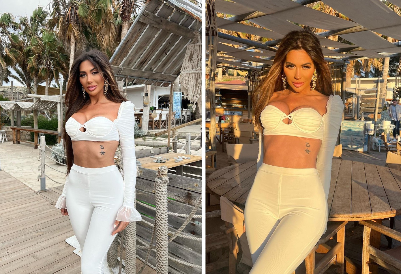 Cư dân mạng khuyên Chloe Ferry nên tìm kiếm sự trợ giúp từ bác sĩ thẩm mỹ. Ảnh: IG.